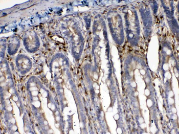 Anti-Cytoglobin/CYGB Antibody
