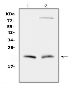 Anti-Cytoglobin/CYGB Antibody
