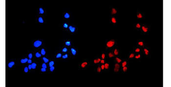 Anti-HMGB1 Antibody