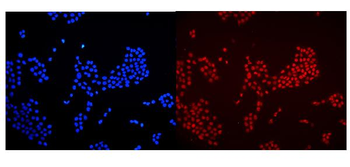 Anti-HMGB1 Antibody