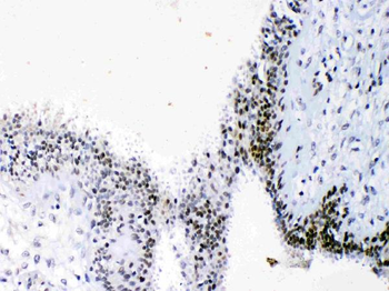 Anti-HMGB1 Antibody