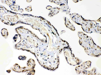 Anti-HMGB1 Antibody