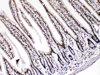 Anti-HMGB1 Antibody