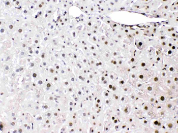 Anti-HMGB1 Antibody