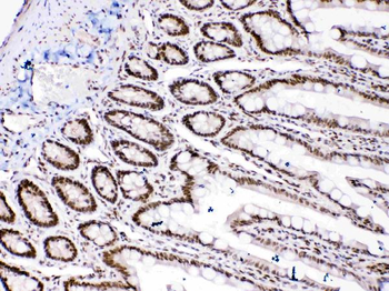 Anti-HMGB1 Antibody