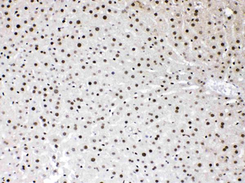 Anti-HMGB1 Antibody