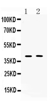 Anti-Islet 1/ISL1 Antibody