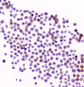 CD11a/ITGAL Antibody