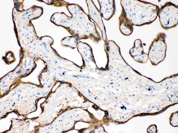Anti-Cytokeratin 18/KRT18 Antibody