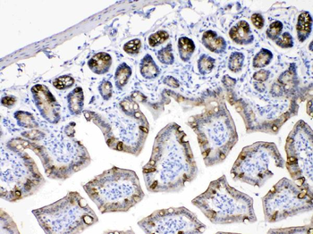 Anti-Cytokeratin 18/KRT18 Antibody