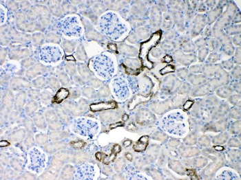 Anti-Cytokeratin 18/KRT18 Antibody