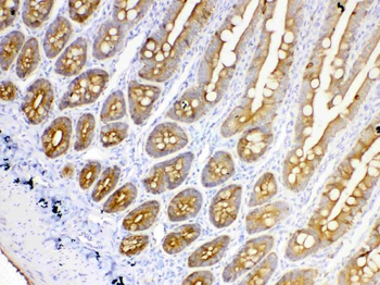 Anti-Cytokeratin 18/KRT18 Antibody