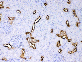 Anti-Cytokeratin 18/KRT18 Antibody