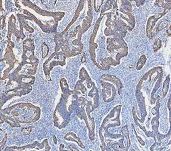 Anti-Cytokeratin 18/KRT18 Antibody