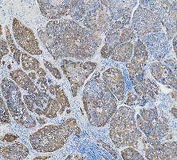 Anti-Cytokeratin 18/KRT18 Antibody