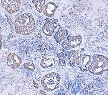 Anti-Cytokeratin 18/KRT18 Antibody