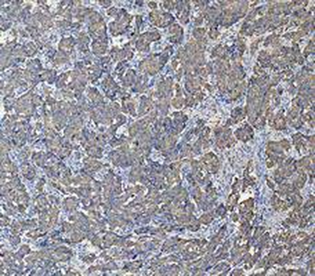 Anti-Cytokeratin 18/KRT18 Antibody