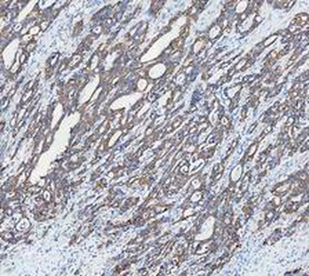 Anti-Cytokeratin 18/KRT18 Antibody