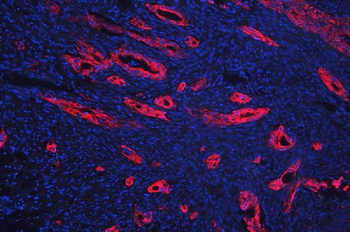 Anti-Cytokeratin 18/KRT18 Antibody