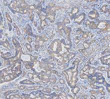 Anti-Cytokeratin 18/KRT18 Antibody
