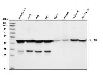 Anti-Cytokeratin 18/KRT18 Antibody