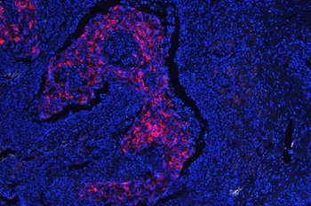 Anti-Cytokeratin 18/KRT18 Antibody