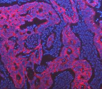 Anti-Cytokeratin 18/KRT18 Antibody