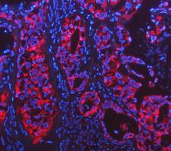 Anti-Cytokeratin 18/KRT18 Antibody