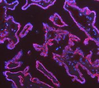 Anti-Cytokeratin 18/KRT18 Antibody
