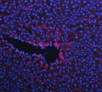 Anti-Cytokeratin 18/KRT18 Antibody