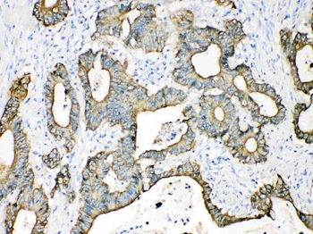 Anti-Cytokeratin 18/KRT18 Antibody