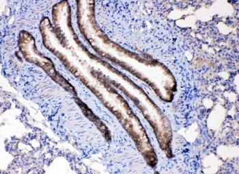 Anti-Leptin Receptor/LEPR Antibody