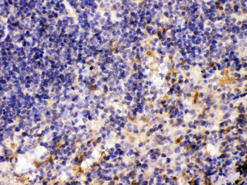 Anti-MMP11 Antibody