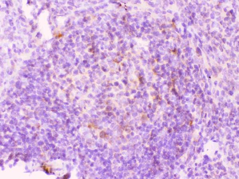 Anti-MMP11 Antibody