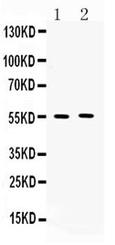 Anti-MMP11 Antibody