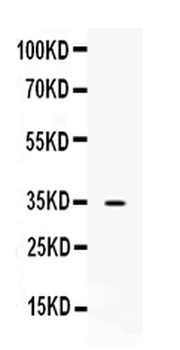 NAT1 Rabbit Polyclonal Antibody