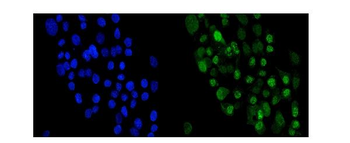 Anti-Periplakin/PPL Antibody