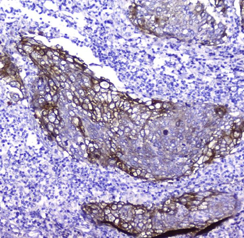 Anti-Periplakin/PPL Antibody