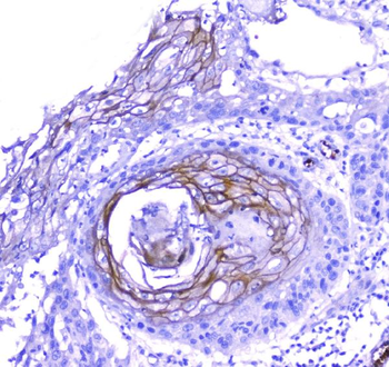 Anti-Periplakin/PPL Antibody