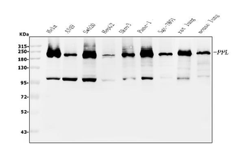 Anti-Periplakin/PPL Antibody