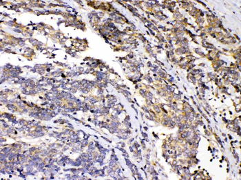 Anti-Protein Kinase A regulatory subunit I alpha/PRKAR1A Antibody