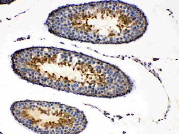 Anti-Protein Kinase A regulatory subunit I alpha/PRKAR1A Antibody