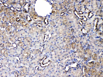 Anti-Protein C inhibitor/SERPINA5 Antibody
