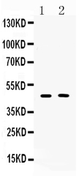 Anti-Protein C inhibitor/SERPINA5 Antibody