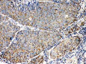 TECTA Antibody