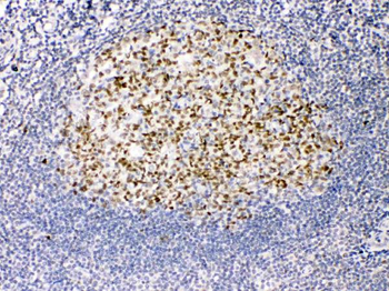 Anti-TRF2/TERF2 Antibody