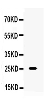 TNF alpha Antibody