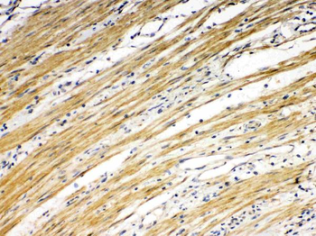 Anti-DR5/TNFRSF10B Antibody