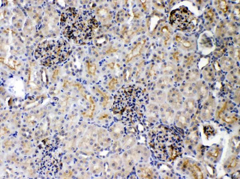 Anti-DR5/TNFRSF10B Antibody