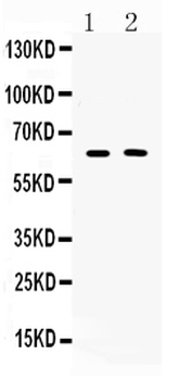 TUB 1 Rabbit Polyclonal Antibody